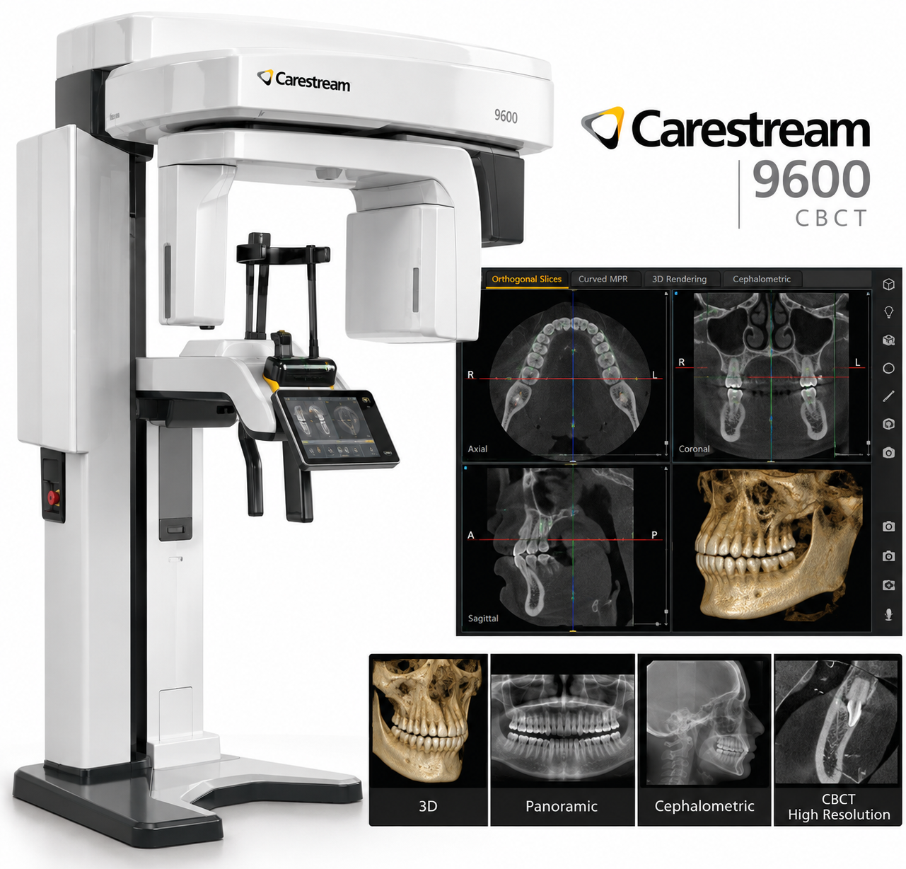 CBCT – Carestream 9600