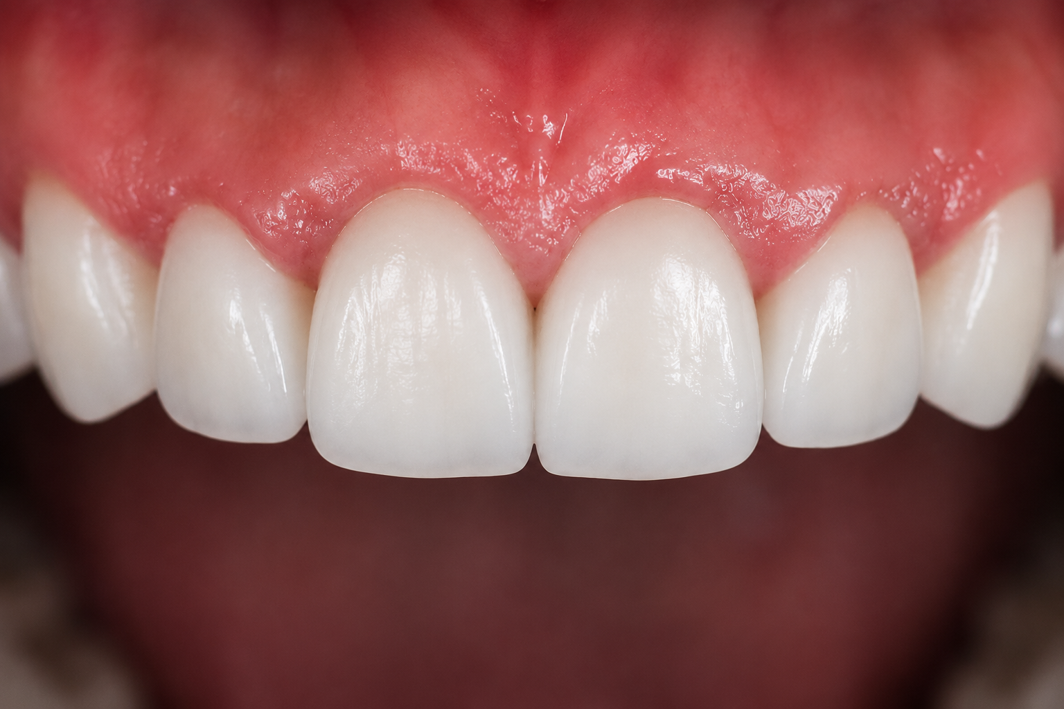 After treatment