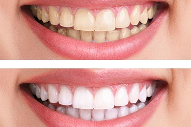 Cosmetic & Smile Dentistry