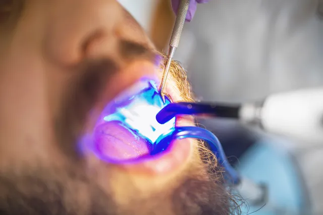 Laser & Minor Oral Procedures